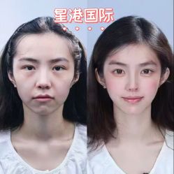 -星港国际·Skin皮肤专研·皮肤管理