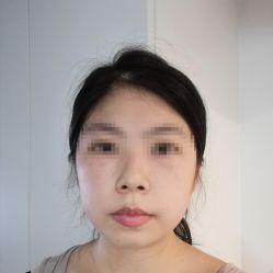 体验前-重庆联合丽格第五医疗美容医院