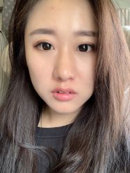 体验后-北京丽星翼美医疗美容