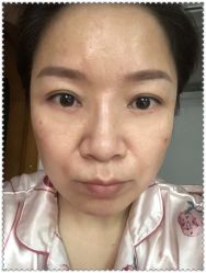 点击看大图 -天津健丽·去眼袋医疗美容机构