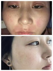 -黎蓓露·徒手骨雕蛋白抗衰·调肤管理