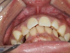 -同步齿科·数字化正畸种植口腔中心(珠海店)