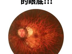 -诺柯视眼镜-蔡司依视路官方工厂店(淞南一店)