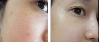 -SKINIST丽铂医疗美容