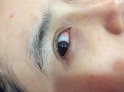 -晶奕空间专业脱毛连锁机构