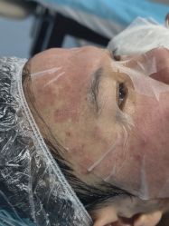 -长沙雅美医疗美容医院