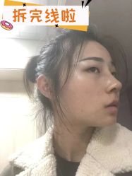 -素美医疗美容·西南眼鼻整形·修复基地