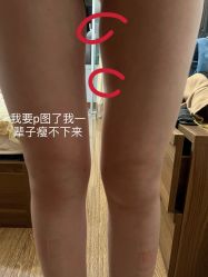 -洁铭新加坡医美