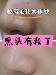 -SKIN79皮肤管理中心
