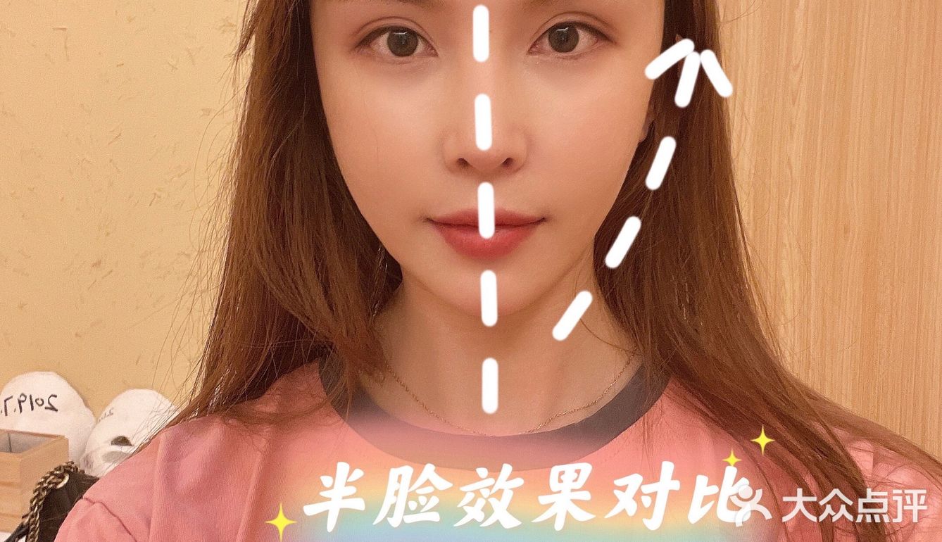 双井不可错过的小颜秘整骨