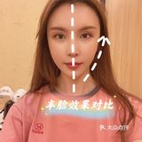 双井不可错过的小颜秘整骨