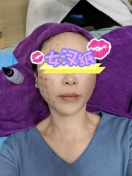 体验后-美莱医学美容医院