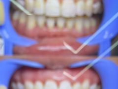 -极光口腔·矫正种植修复(锦江院区)