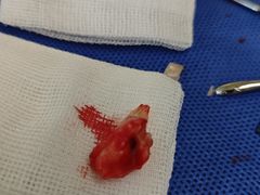 -北京大学口腔医院(第三门诊部)