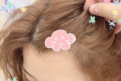 -大麦微针植发全国连锁