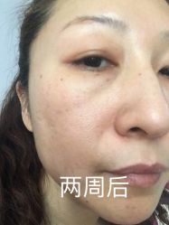 -天津伊美尔医疗整形美容专科医院
