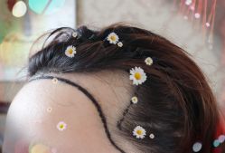 -大麦微针植发全国连锁