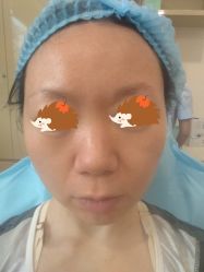 体验后-上海玫瑰医疗美容医院