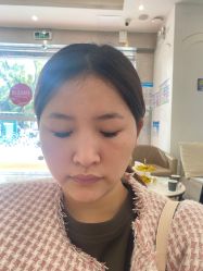 -广州健丽·去眼袋医疗美容机构