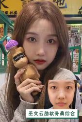 -北京米扬丽格医疗美容·联合丽格鼻整形中心