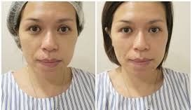 -SKINIST丽铂医疗美容