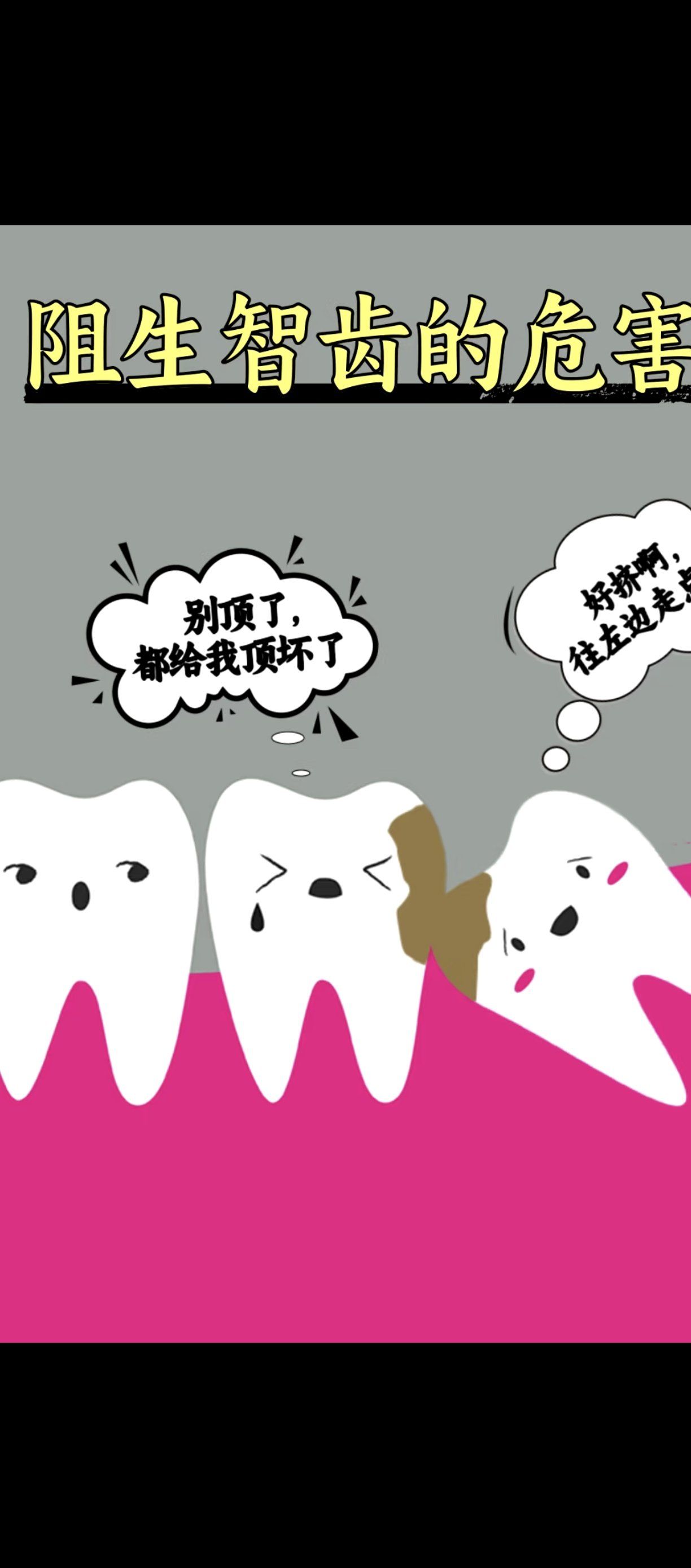 一,阻生智齿的危害主要有以下几个方面:1冠周炎