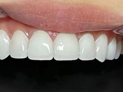 点击看大图 -美朵纹绣美牙纹眉工作室