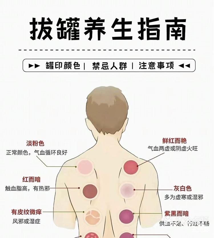 拔火罐后的出痧颜色代表什么问题?拔罐后