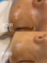 -东森自然美.INDIBA.美容SPA.皮肤管理