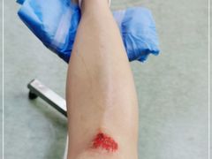 -广州市红十字会医院(总院)