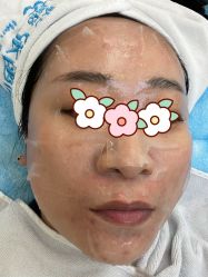 体验后-联合丽格·张菡丽格医疗美容