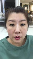 -天津健丽·去眼袋医疗美容机构