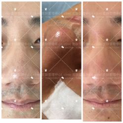 -素妍印象Ekrin Medi Clinic