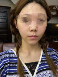 体验后-天津伊美尔医疗整形美容专科医院