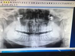 -赛百味SUBWAY(金宝汇店)