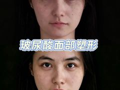 -上海仁爱医院