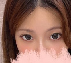 -天津健丽·去眼袋医疗美容机构