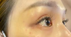 -深圳春天阳光医院·轮廓抗衰中心