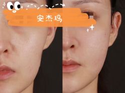 -安杰玛SPA会所