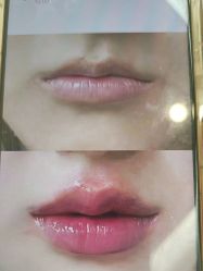 -郡艺医疗美容·微整·眼鼻吸脂