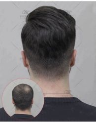 -发饰美男士增发补发假发定制店