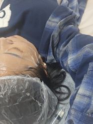 -长沙雅美医疗美容医院