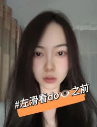 体验前-青岛诺德医学美容医院