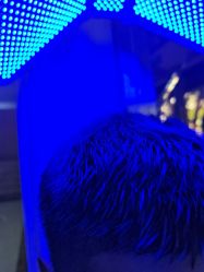 -碧莲盛·不剃发植发