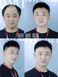 -型男帮男士假发补发·佩戴式发型
