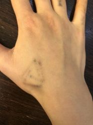 -天道专业洗纹身
