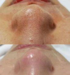 -洋子Nail Skincare