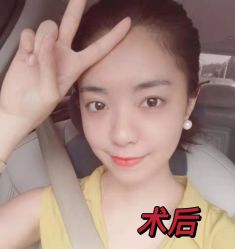 -天津健丽·去眼袋医疗美容机构