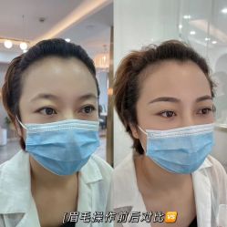 点击看大图 -Verywang半永久纹眉•仪器野生眉