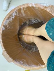 -派恩宜灰指甲鸡眼嵌甲手足癣